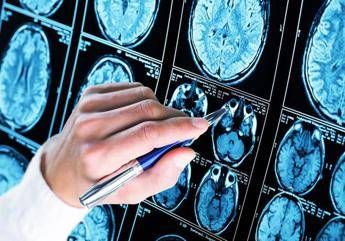 alzheimer 300mila euro a 6 scienziati per diagnosi precoce e prevenzione 2