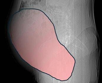 ?attachment id=91167