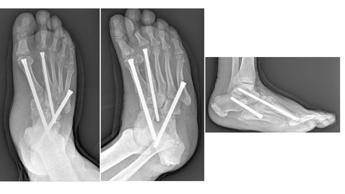 ?attachment id=97332